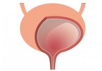 bladder and strengthening of the capsules of the femixal organs